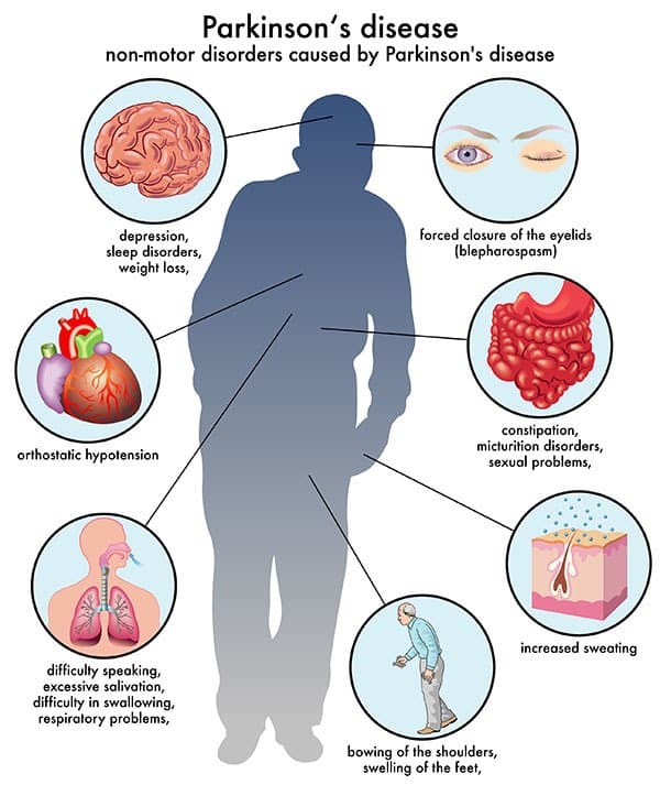 15 Early Signs Of Parkinson