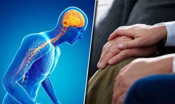 Brain condition: Parkinsons disease set to outpace Alzheimers by ...