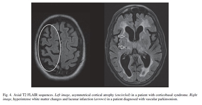 Clinical Application of Brain MRI in the Diagnostic Work