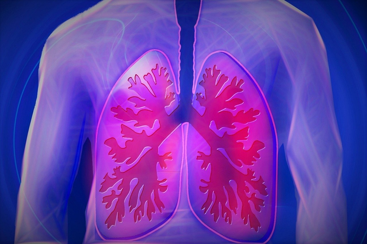 Common asbestos lung disease does not increase risk of ...