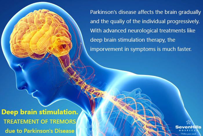 Deep brain stimulation. TREATEMENT OF TREMORS due to # ...
