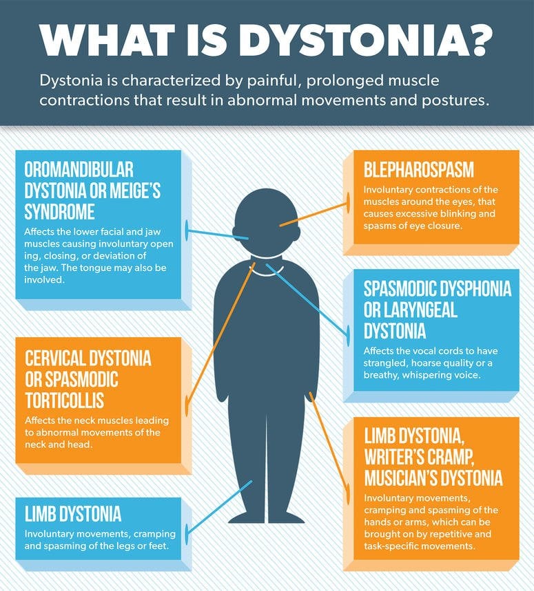 Penyakit Dystonia - Homecare24