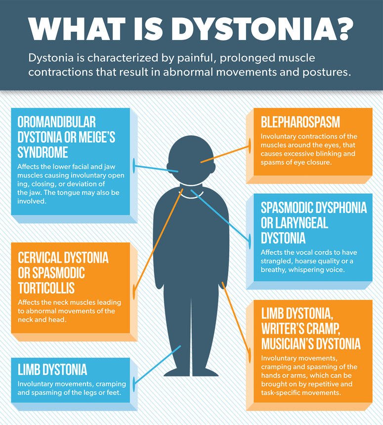 Penyakit Dystonia - Homecare24