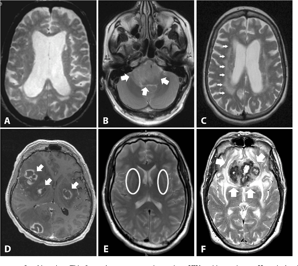Figure 1 from Magnetic resonance imaging for the diagnosis of Parkinson ...