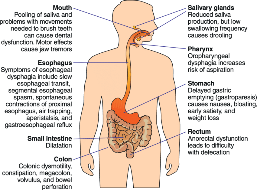Gastrointestinal dysfunctions and symptoms in Parkinson