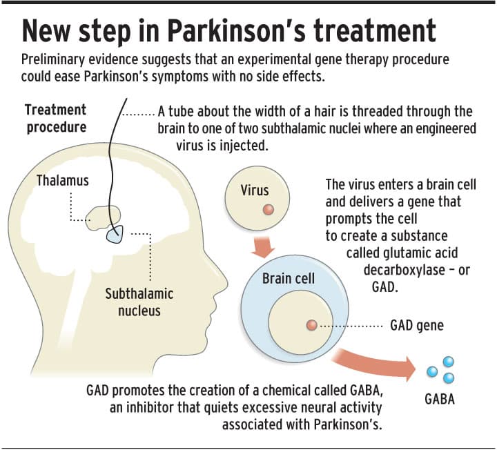Gene therapy shows promise for easing Parkinsons disease