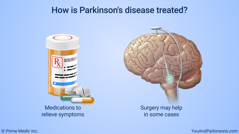 How is Parkinson