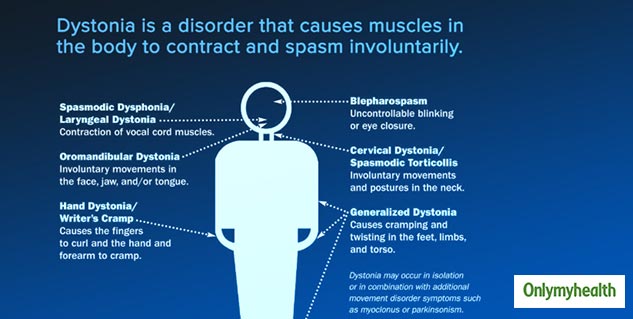 Involuntary Movements Can Be Dystonia. Know All About This ...