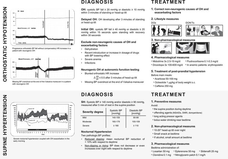 Management of Orthostatic Hypotension in Parkinsons Disease
