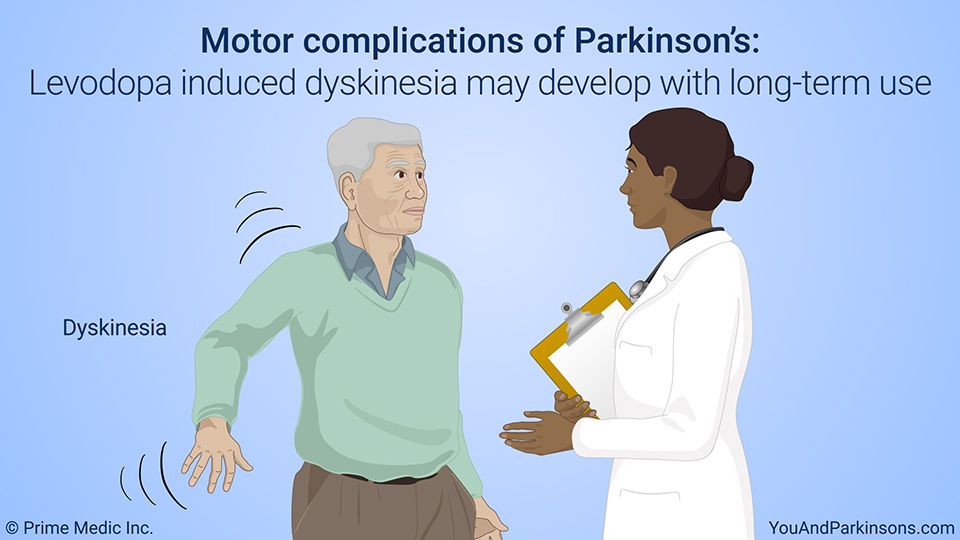 Motor complications of Parkinsons disease: Levodopa