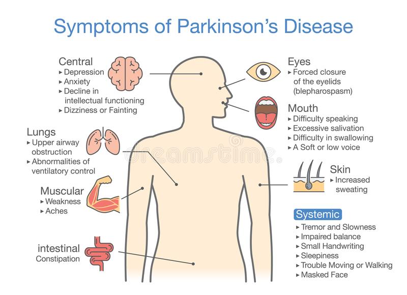 Parkinson s disease stock vector. Illustration of human ...