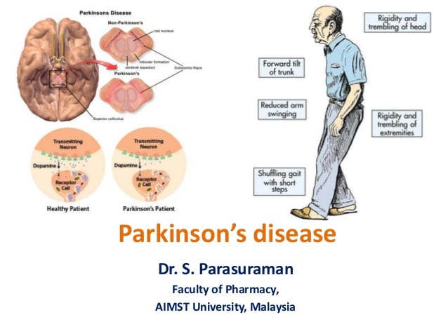 Parkinsons Disease Causes Of Death