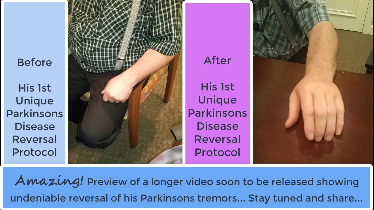 Parkinsons Disease Tremor Improvements That Last!
