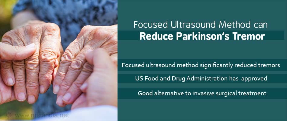 Parkinsons Tremors can now be Reduced by the Focused Ultrasound Procedure
