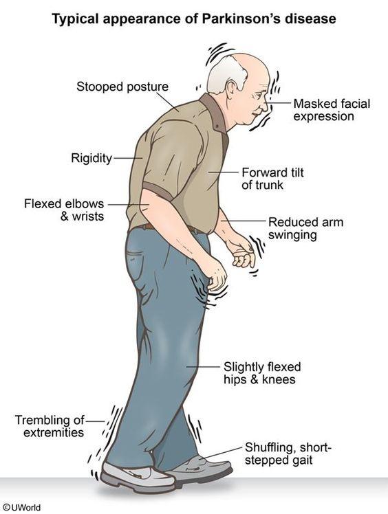 What are the symptoms of parkinsons?