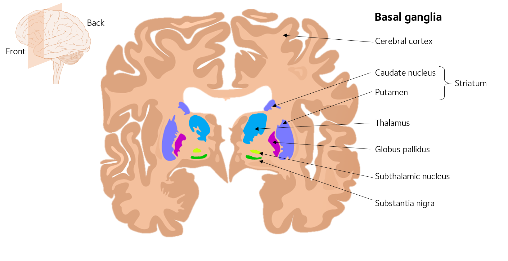 What brain areas are affected by Parkinsons?  Parkinson ...